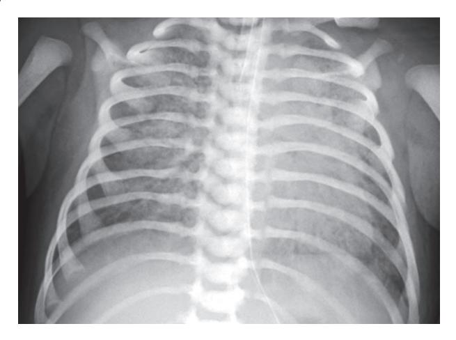 images/VVK-P-Osce 18. Radiology_page_15_Picture_4.jpeg