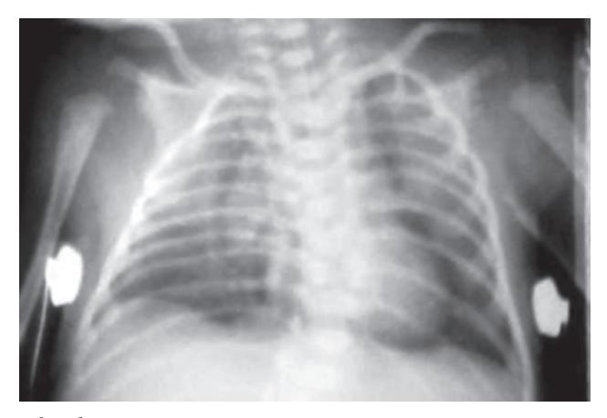 images/VVK-P-Osce 18. Radiology_page_15_Picture_9.jpeg
