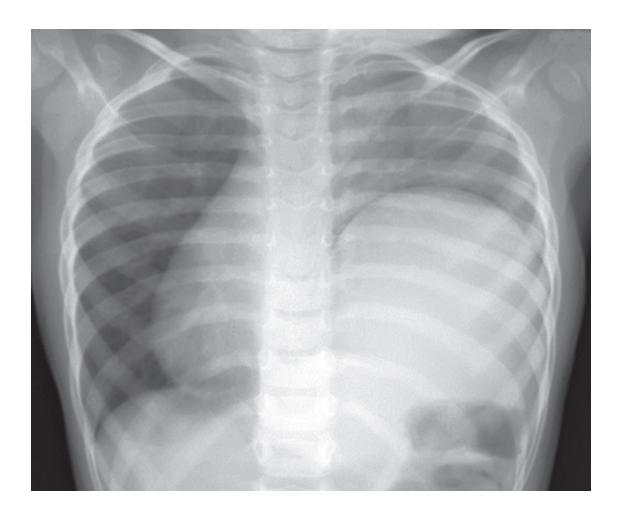 images/VVK-P-Osce 18. Radiology_page_16_Picture_10.jpeg