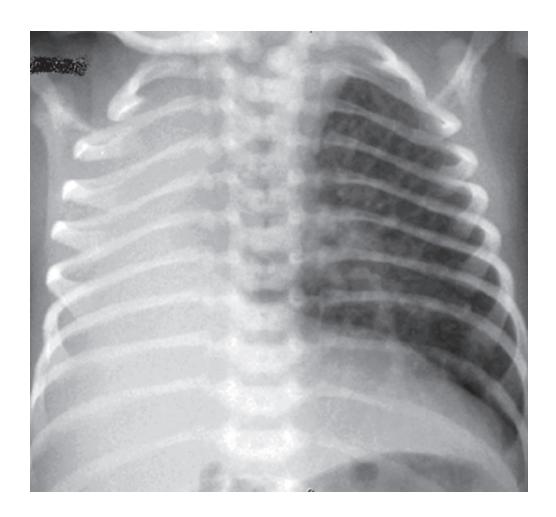 images/VVK-P-Osce 18. Radiology_page_16_Picture_5.jpeg