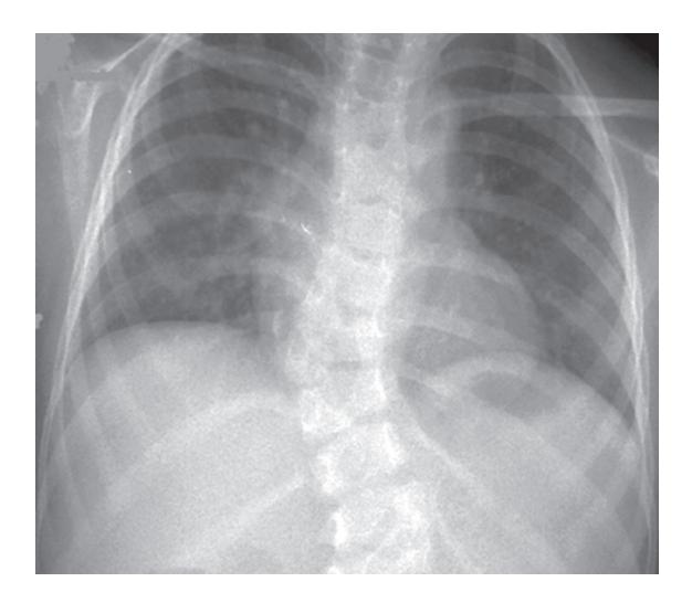 images/VVK-P-Osce 18. Radiology_page_17_Picture_3.jpeg