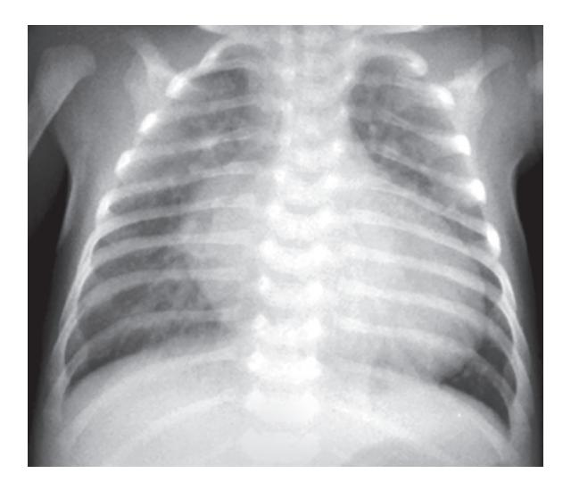 images/VVK-P-Osce 18. Radiology_page_17_Picture_9.jpeg