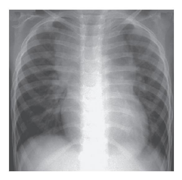 images/VVK-P-Osce 18. Radiology_page_18_Picture_11.jpeg