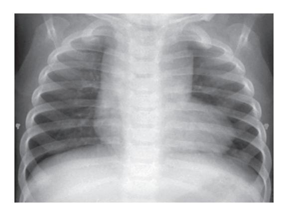 images/VVK-P-Osce 18. Radiology_page_18_Picture_5.jpeg