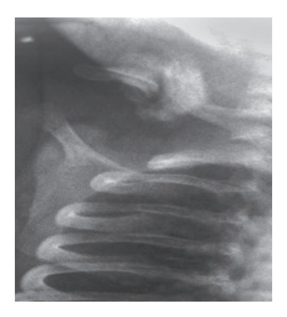 images/VVK-P-Osce 18. Radiology_page_1_Picture_3.jpeg