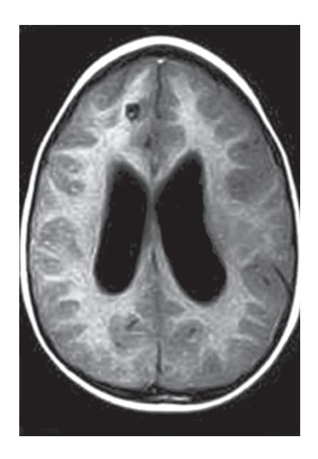 images/VVK-P-Osce 18. Radiology_page_1_Picture_8.jpeg