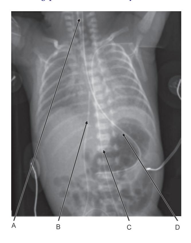 images/VVK-P-Osce 18. Radiology_page_2_Picture_10.jpeg