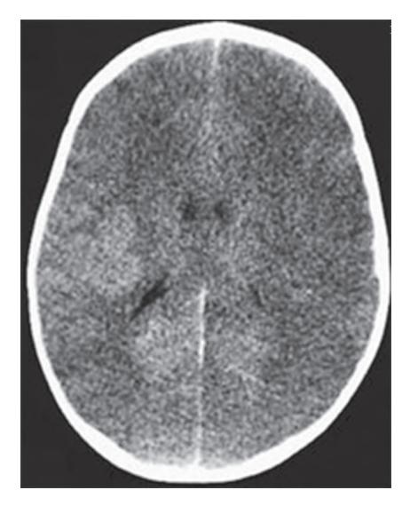 images/VVK-P-Osce 18. Radiology_page_3_Picture_3.jpeg