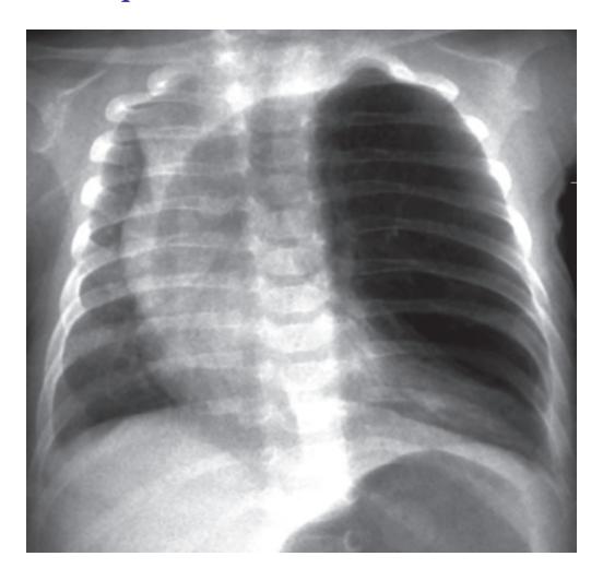 images/VVK-P-Osce 18. Radiology_page_3_Picture_8.jpeg