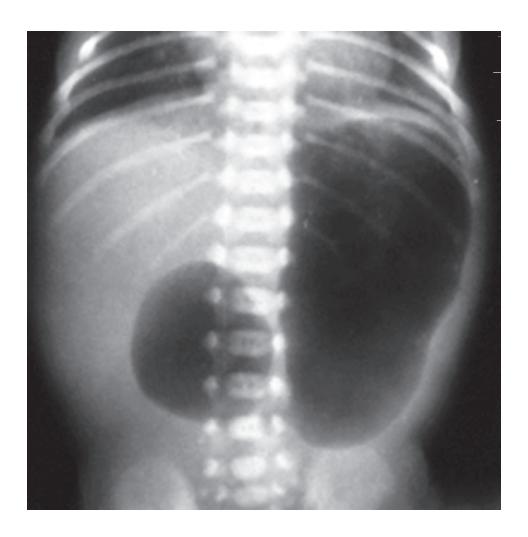 images/VVK-P-Osce 18. Radiology_page_4_Picture_3.jpeg