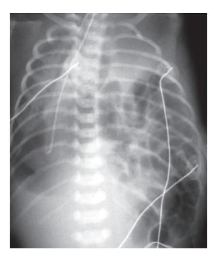 images/VVK-P-Osce 18. Radiology_page_4_Picture_9.jpeg