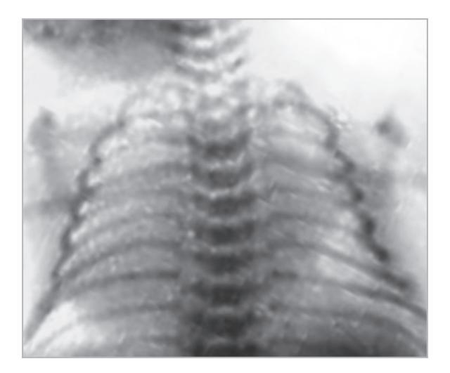 images/VVK-P-Osce 18. Radiology_page_5_Picture_10.jpeg