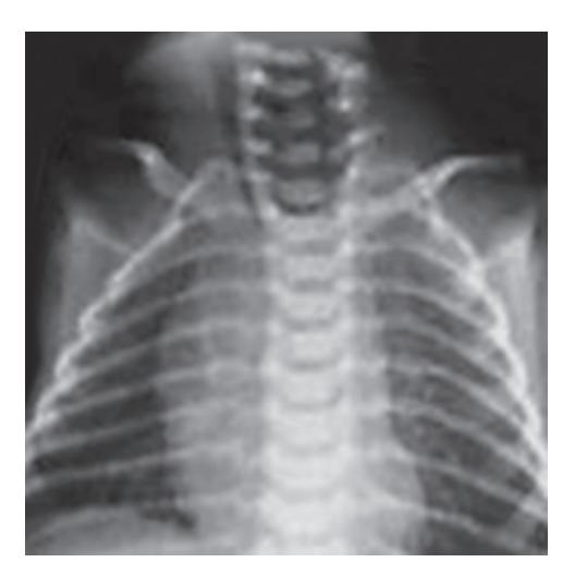 images/VVK-P-Osce 18. Radiology_page_5_Picture_5.jpeg