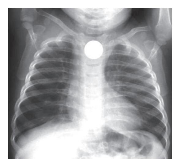 images/VVK-P-Osce 18. Radiology_page_6_Picture_11.jpeg