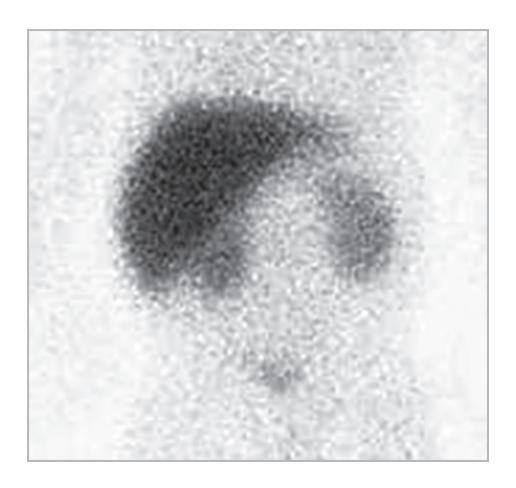 images/VVK-P-Osce 18. Radiology_page_6_Picture_5.jpeg