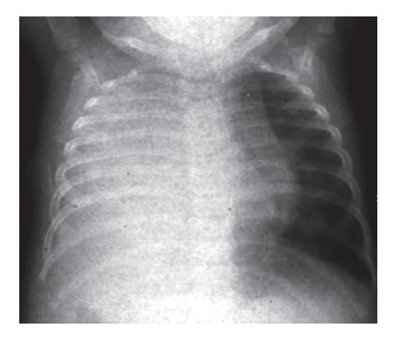 images/VVK-P-Osce 18. Radiology_page_7_Picture_10.jpeg