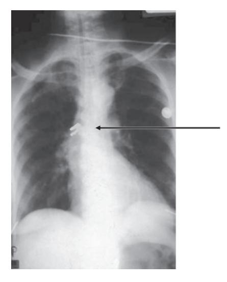 images/VVK-P-Osce 18. Radiology_page_7_Picture_5.jpeg