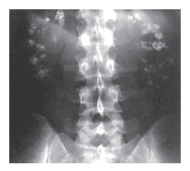 images/VVK-P-Osce 18. Radiology_page_8_Picture_3.jpeg