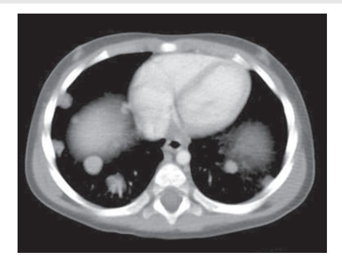 images/VVK-P-Osce 18. Radiology_page_9_Picture_2.jpeg