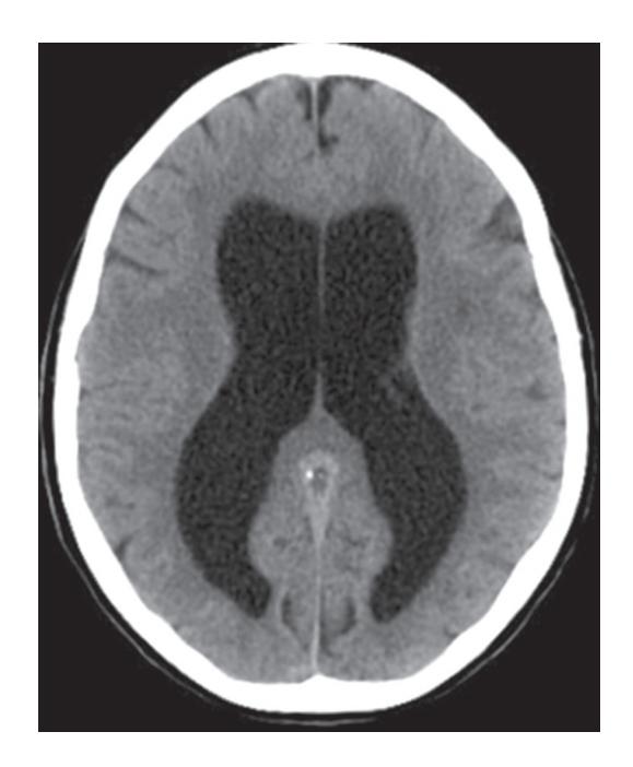 images/VVK-P-Osce 18. Radiology_page_9_Picture_8.jpeg