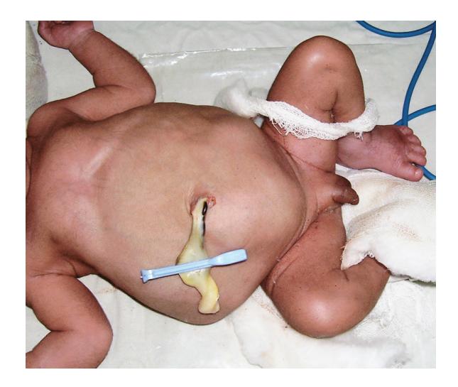 images/VVK-P-Osce 19. Renal System_page_4_Picture_7.jpeg