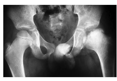 images/VVK-P-Osce 20. Orthopedics_page_2_Picture_13.jpeg
