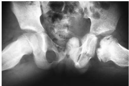 images/VVK-P-Osce 20. Orthopedics_page_2_Picture_14.jpeg