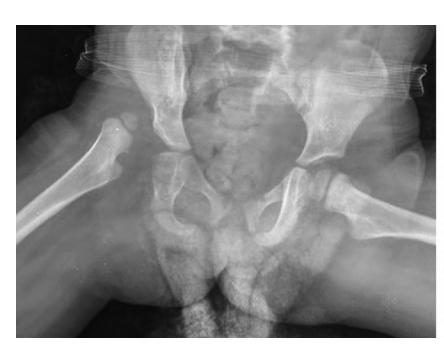 images/VVK-P-Osce 20. Orthopedics_page_2_Picture_3.jpeg