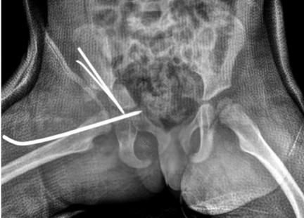 images/VVK-P-Osce 20. Orthopedics_page_2_Picture_4.jpeg