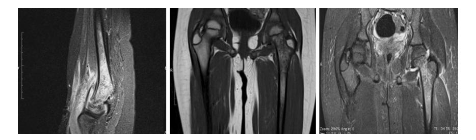 images/VVK-P-Osce 20. Orthopedics_page_3_Picture_3.jpeg