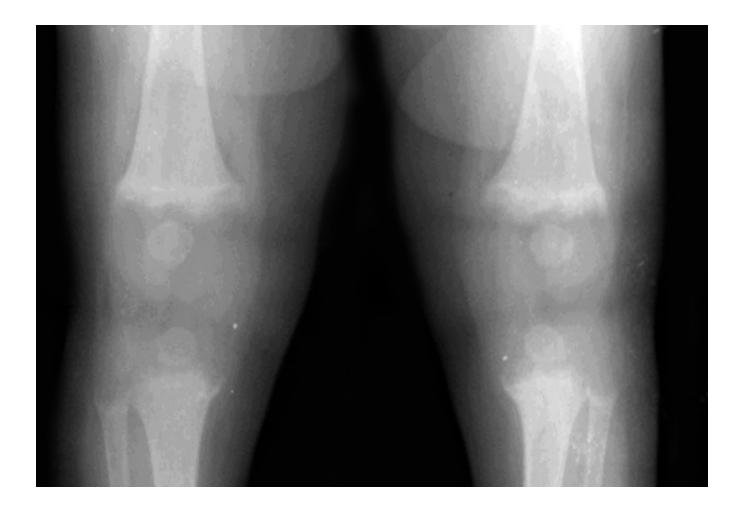 images/VVK-P-Osce 20. Orthopedics_page_3_Picture_9.jpeg