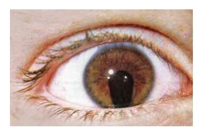 images/VVK-P-Osce 22. Ophthalmology_page_0_Picture_4.jpeg