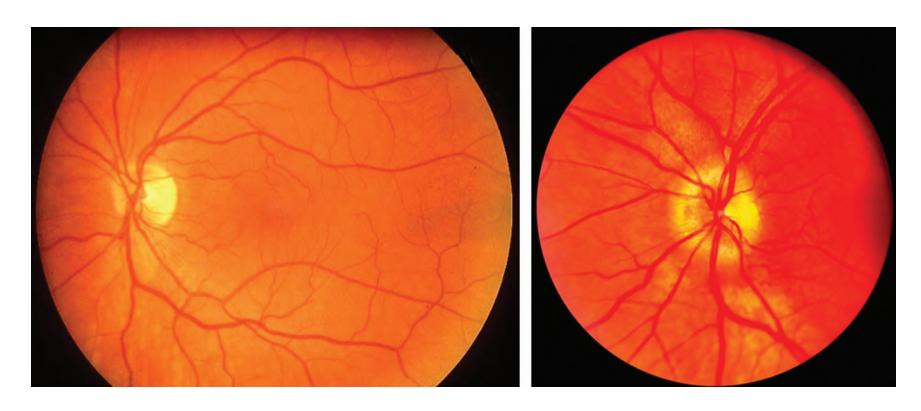 images/VVK-P-Osce 22. Ophthalmology_page_0_Picture_9.jpeg