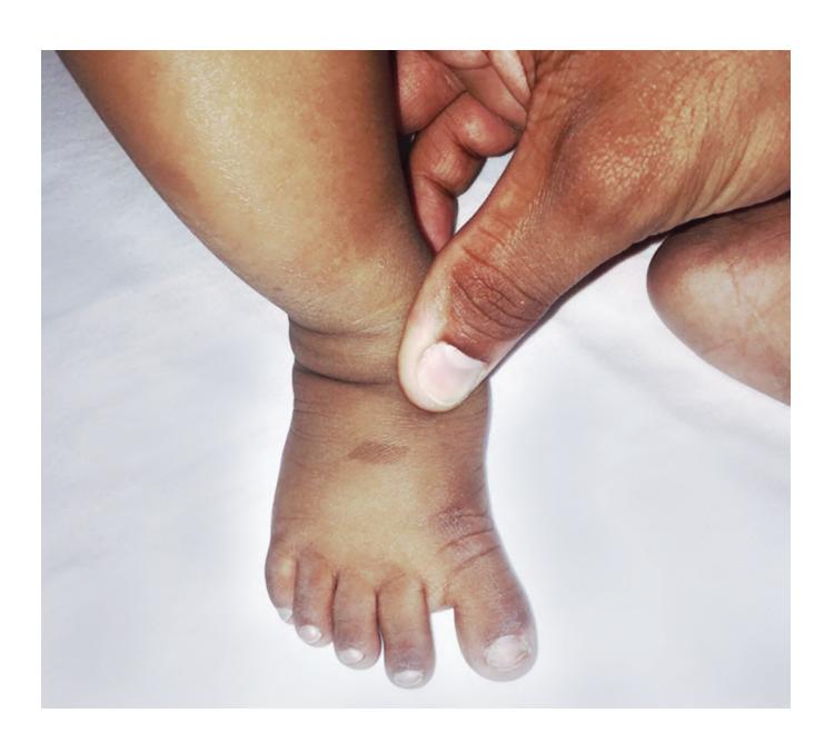 images/VVK-P-Osce 5. Genetics_page_0_Picture_5.jpeg