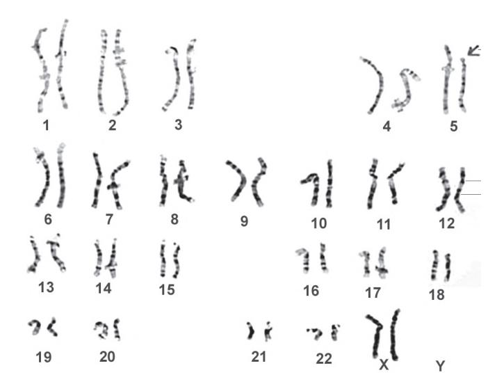 images/VVK-P-Osce 5. Genetics_page_10_Picture_13.jpeg
