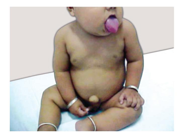 images/VVK-P-Osce 5. Genetics_page_11_Picture_8.jpeg