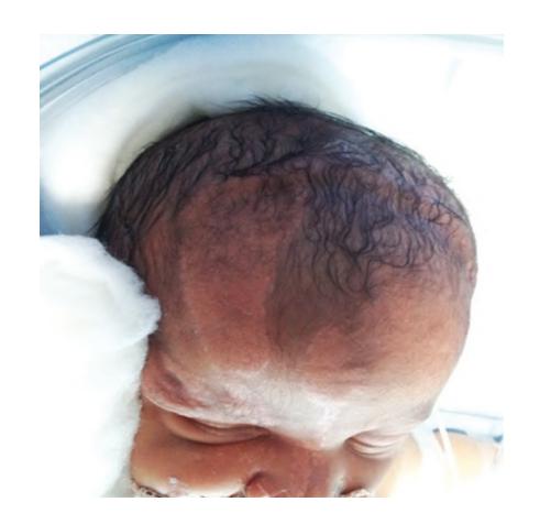 images/VVK-P-Osce 5. Genetics_page_1_Picture_14.jpeg
