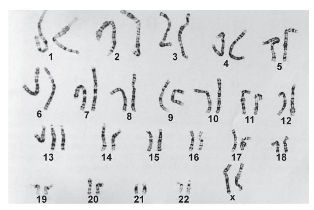 images/VVK-P-Osce 5. Genetics_page_2_Picture_5.jpeg