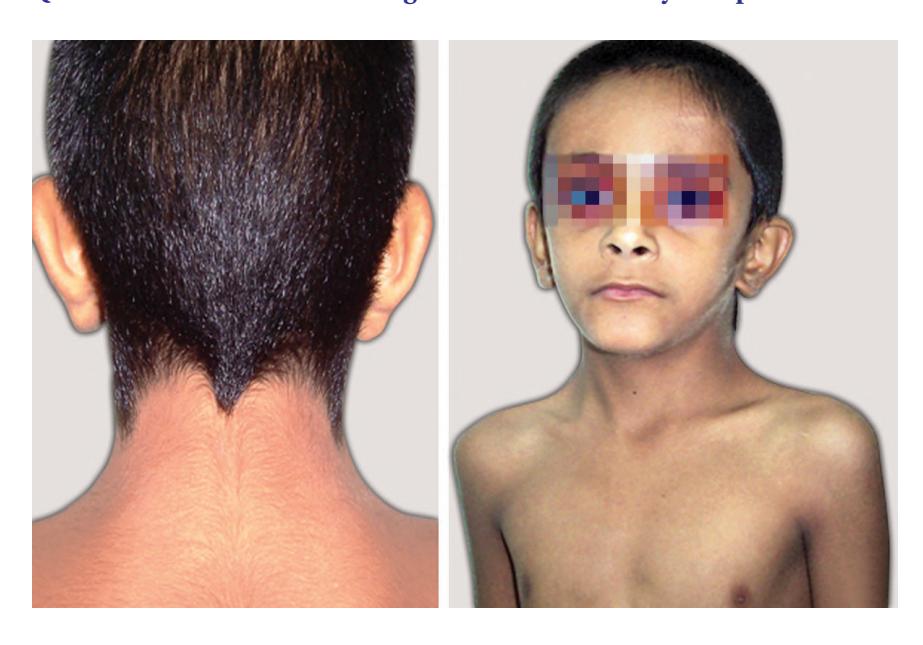 images/VVK-P-Osce 5. Genetics_page_6_Picture_12.jpeg
