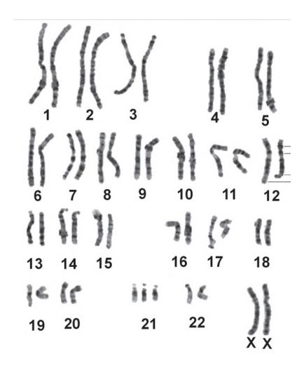 images/VVK-P-Osce 5. Genetics_page_7_Figure_12.jpeg