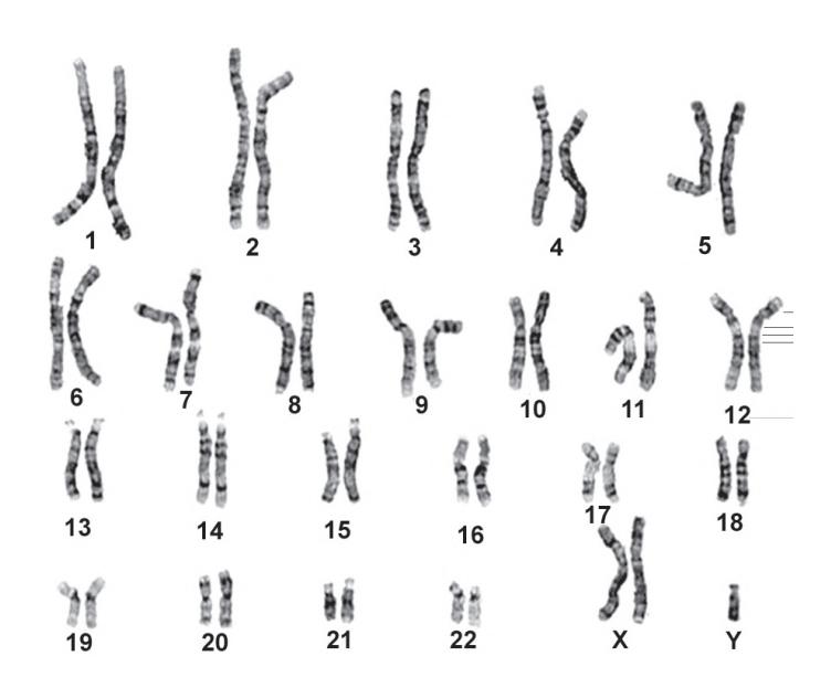 images/VVK-P-Osce 5. Genetics_page_8_Picture_17.jpeg