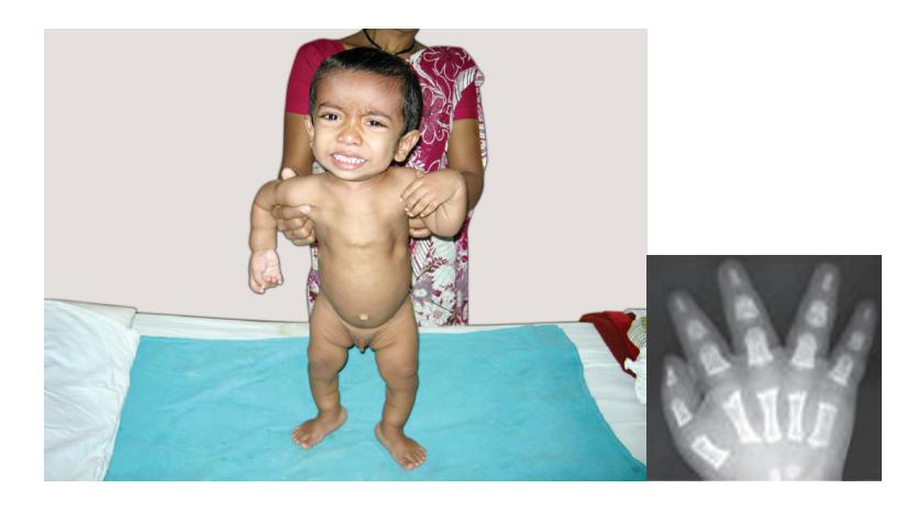 images/VVK-P-Osce 5. Genetics_page_9_Picture_24.jpeg