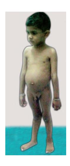 images/VVK-P-Osce 6. Gastrointestinal Disorders_page_0_Picture_13.jpeg
