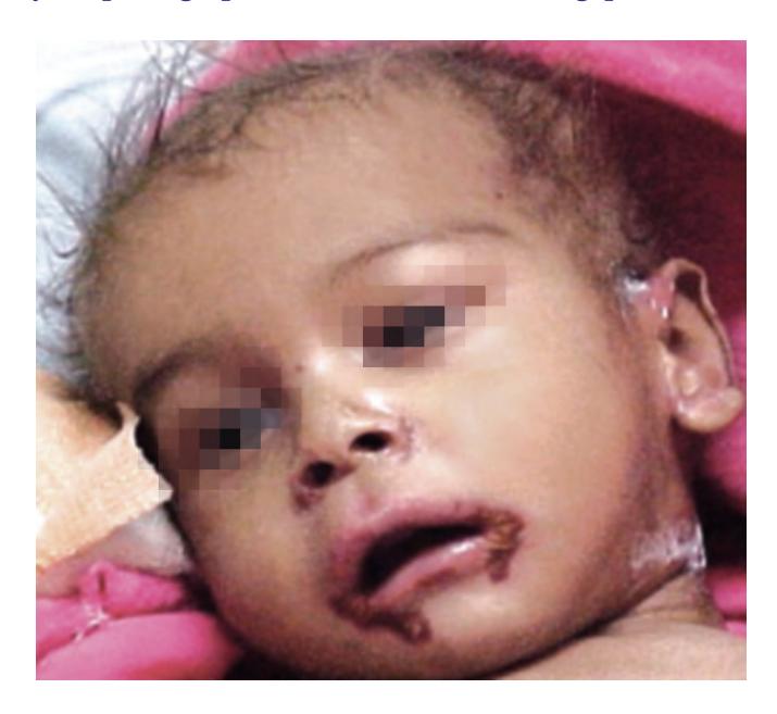 images/VVK-P-Osce 6. Gastrointestinal Disorders_page_2_Picture_3.jpeg
