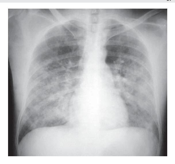 images/VVK-P-Osce 7. Hematology & Oncology_page_1_Picture_2.jpeg