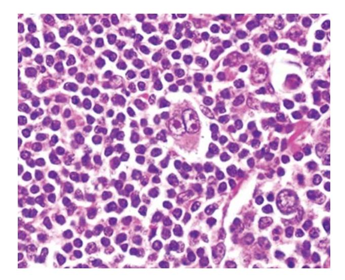 images/VVK-P-Osce 7. Hematology & Oncology_page_1_Picture_4.jpeg