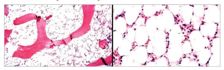 images/VVK-P-Osce 7. Hematology & Oncology_page_3_Picture_9.jpeg