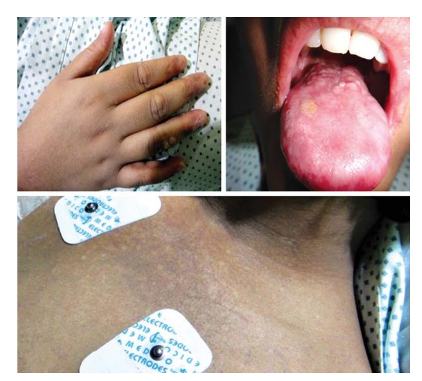 images/VVK-P-Osce 7. Hematology & Oncology_page_4_Picture_3.jpeg