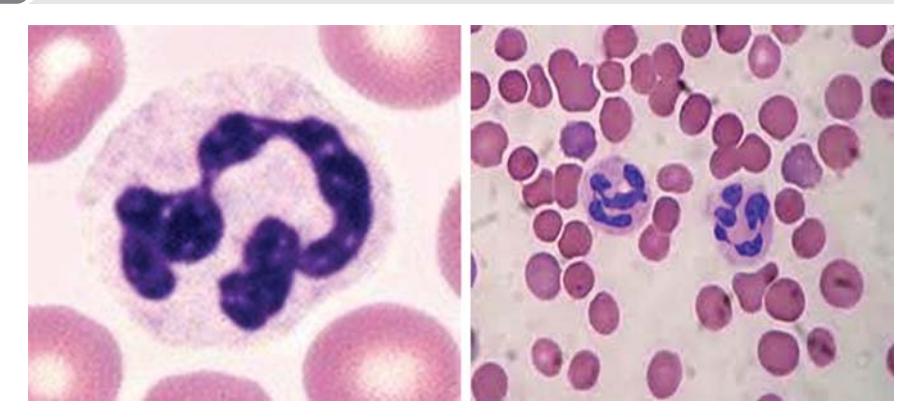 images/VVK-P-Osce 7. Hematology & Oncology_page_6_Picture_2.jpeg