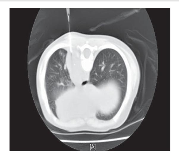 images/VVK-P-Osce 7. Hematology & Oncology_page_8_Picture_2.jpeg